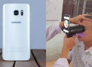 Samsung reinventa sus antiguos modelos celulares y los convierte en dispositivos oftalmológicos