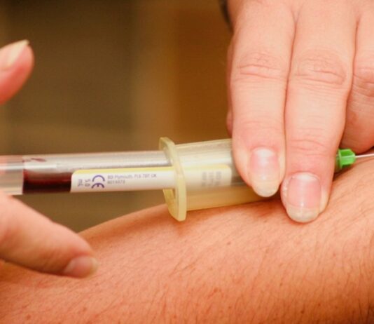 Cáncer de próstata: Chilenas desarrollan innovador examen de sangre para detectar la enfermedad